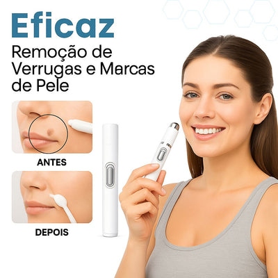 Caneta Laser MediSkin™ - Imagem 2