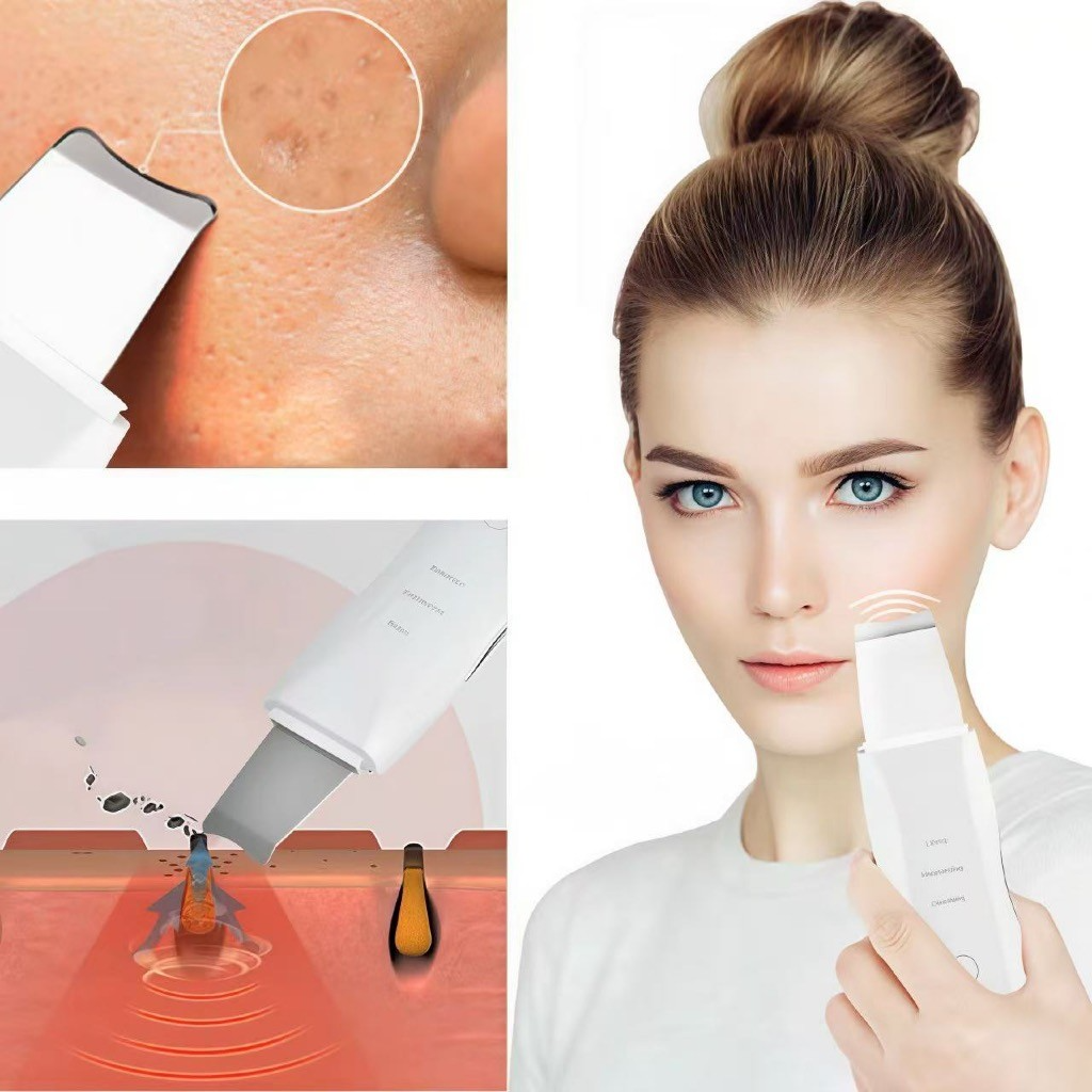 Aparelho de Peeling Ultrassônico Facial – Limpeza Profunda, Esfoliação e Remoção de Cravos - Imagem 2