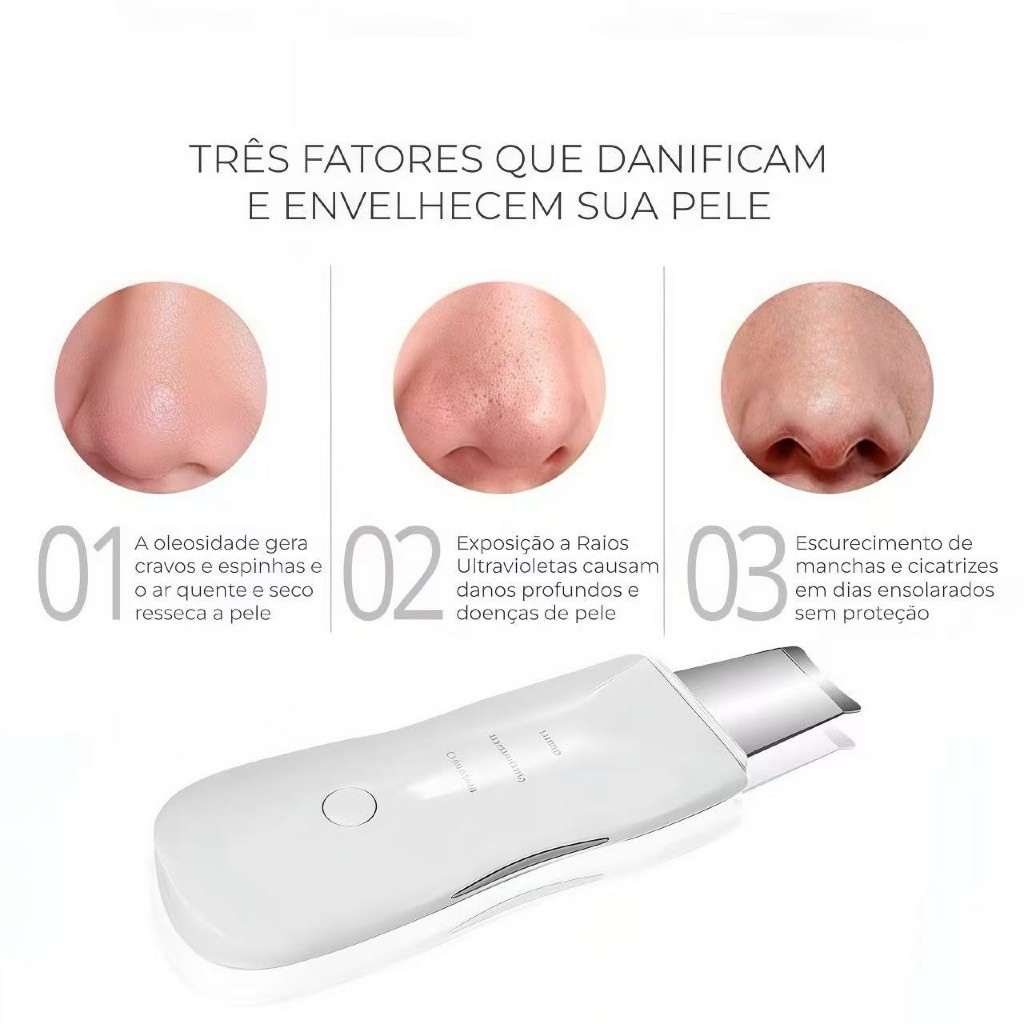 Aparelho de Peeling Ultrassônico Facial – Limpeza Profunda, Esfoliação e Remoção de Cravos - Imagem 3