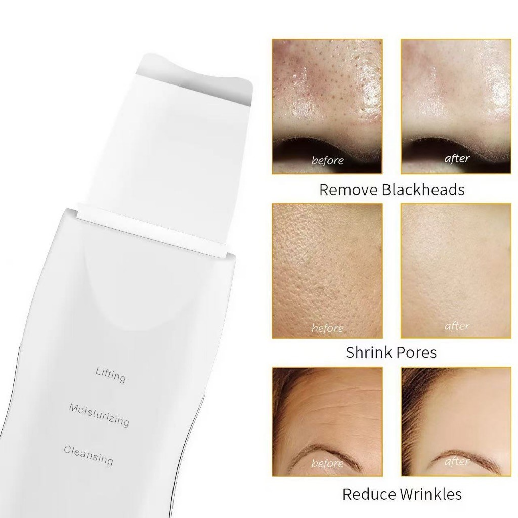 Aparelho de Peeling Ultrassônico Facial – Limpeza Profunda, Esfoliação e Remoção de Cravos - Imagem 5