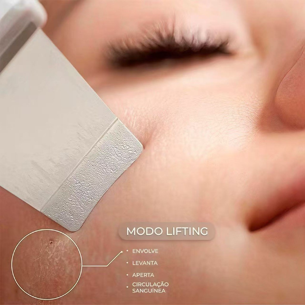 Aparelho de Peeling Ultrassônico Facial – Limpeza Profunda, Esfoliação e Remoção de Cravos - Imagem 6