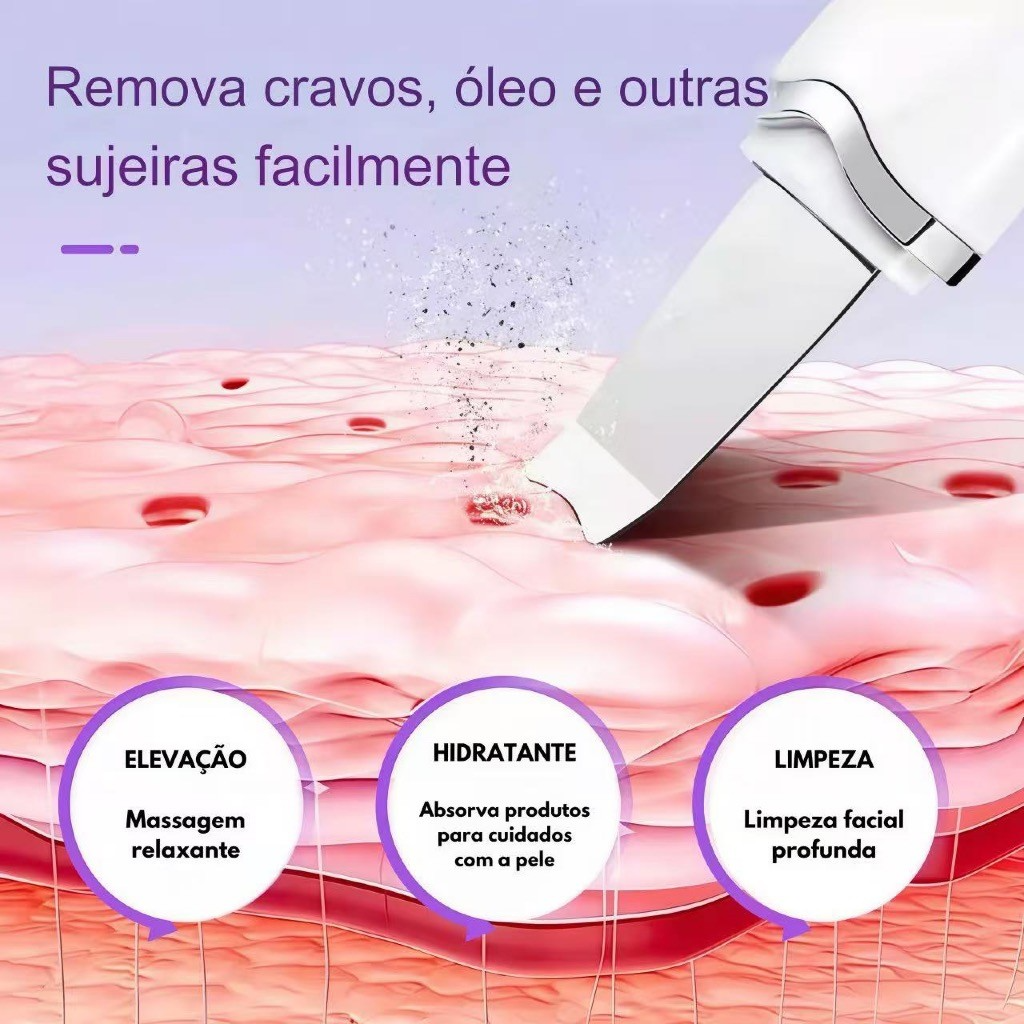 Aparelho de Peeling Ultrassônico Facial – Limpeza Profunda, Esfoliação e Remoção de Cravos - Imagem 7