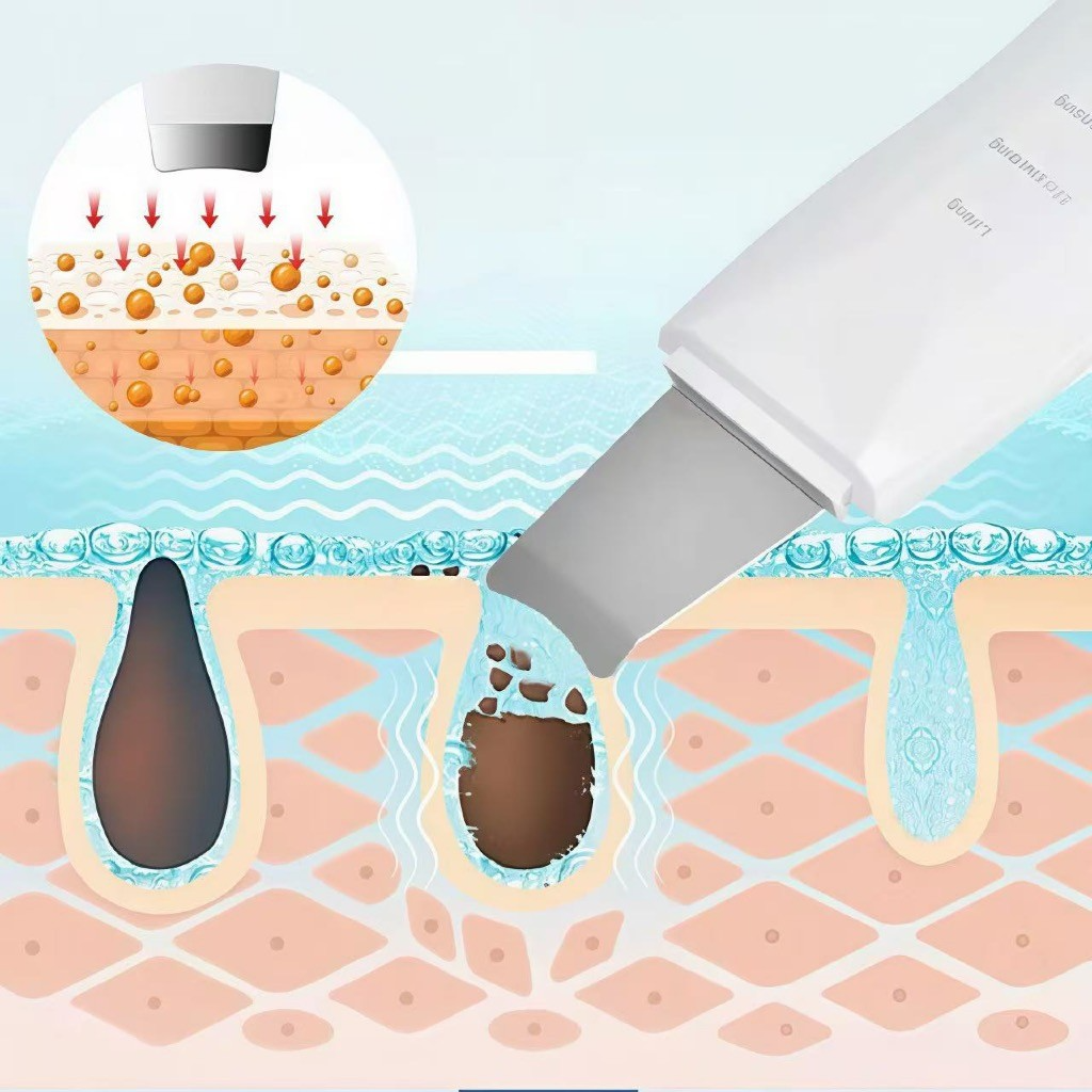 Aparelho de Peeling Ultrassônico Facial – Limpeza Profunda, Esfoliação e Remoção de Cravos - Imagem 8